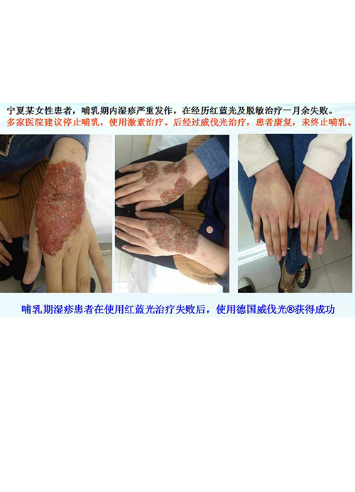 慢性炎症